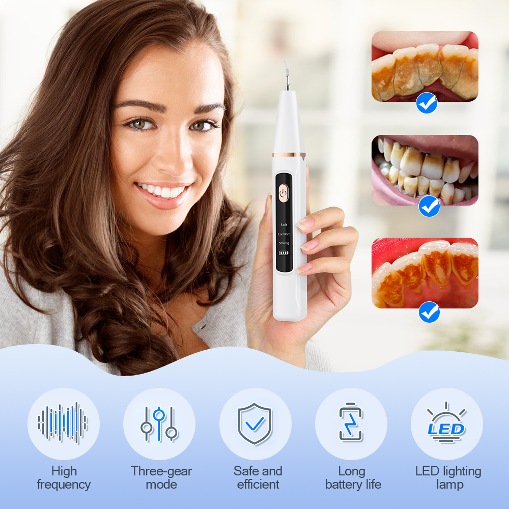 Pulitore per denti ad ultrasuo - Rotary Tool Kit recensione e prezzo